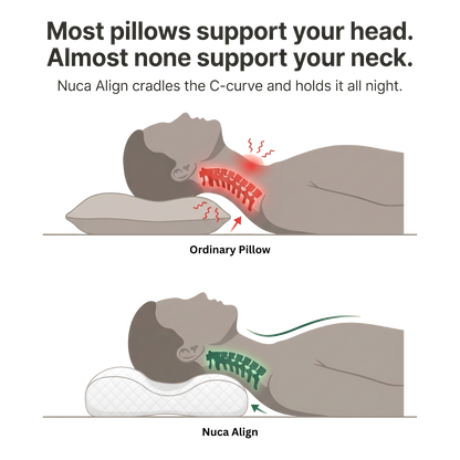 Nuca Align